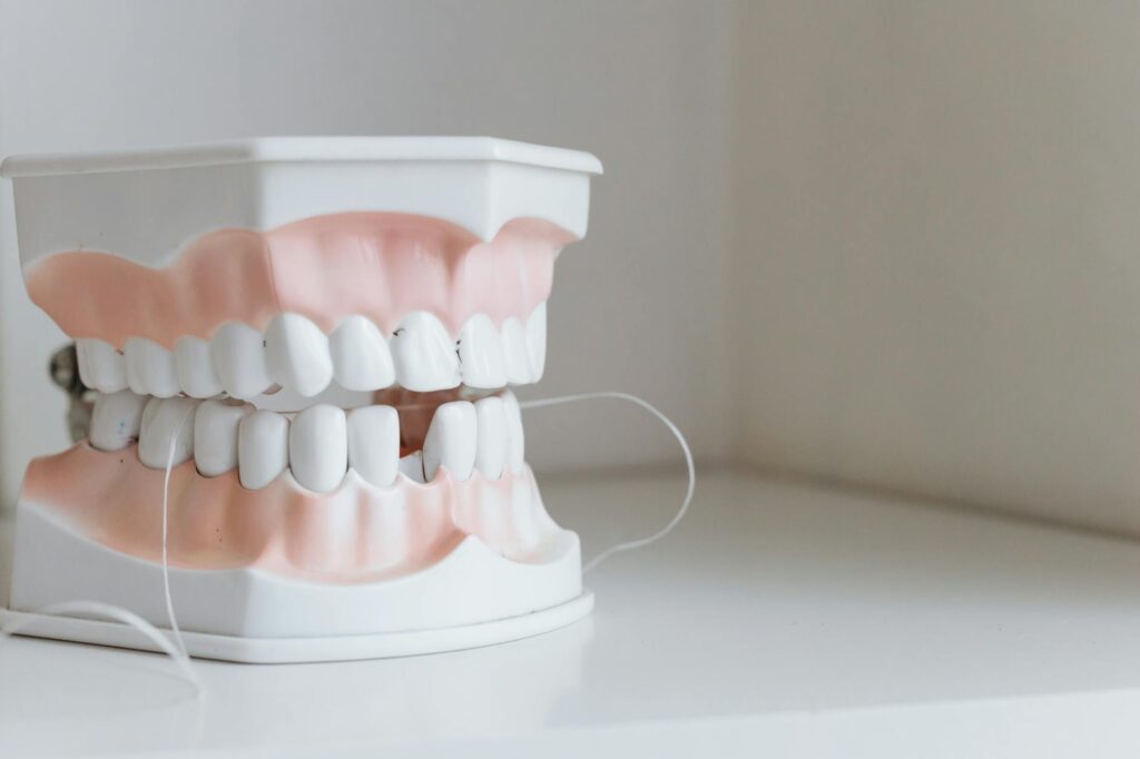 Gummy smile: cum corectezi zâmbetul gingival